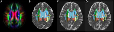 Structural network efficiency mediates the association between glymphatic function and cognition in mild VCI: a DTI-ALPS study